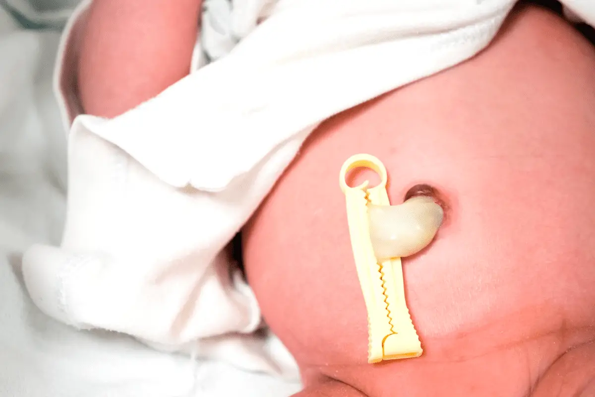 Umbilical cord stump care – what parents need to know