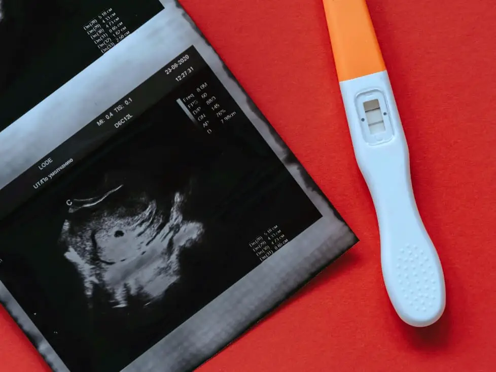 ultrasound picture and positive pregnancy test